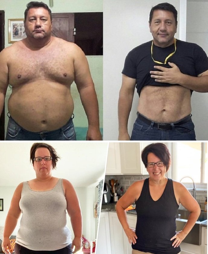 Hígado graso — Dr. Andre Martinez