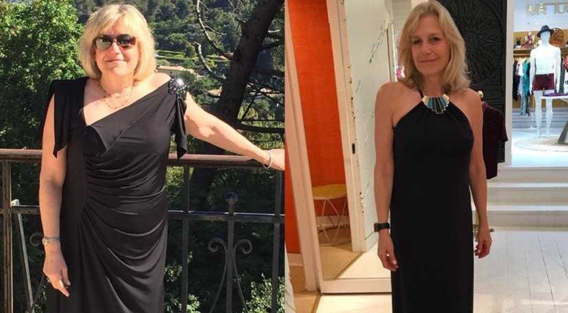 Antes / Después - Marta